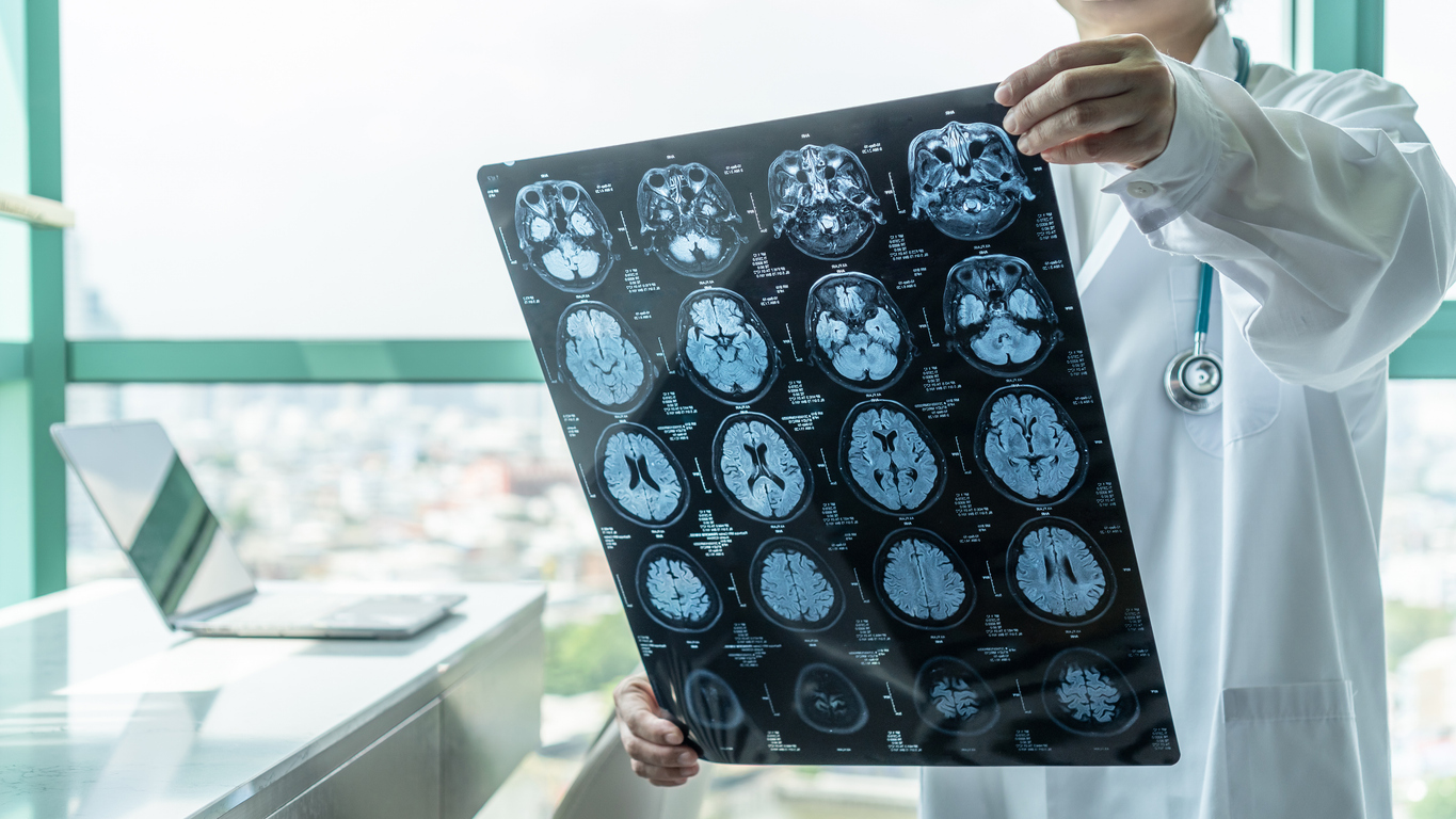 houston brain injury lawyers